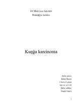 Презентация 'Kuņģa karcinoma', 1.