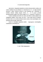 Презентация 'Kuņģa karcinoma', 20.
