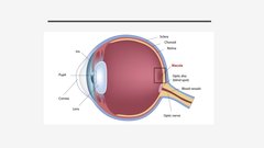 Презентация 'Makulas deģenerācija', 3.
