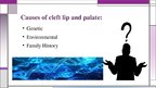 Презентация 'Cleft Lip and Palate', 5.