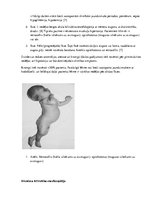Реферат 'Bilirubīna metabolisms un neirotoksicitāte jaundzimušajiem', 6.