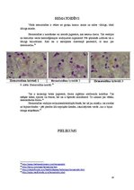 Конспект 'Fizioloģiskie hemoglobinogēnie pigmenti', 14.