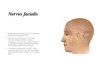 Презентация 'Nervus facialis parēze', 2.
