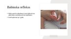 Презентация 'Jaundzimušā refleksi', 8.