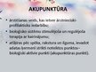 Презентация 'Akupunktūra', 4.