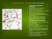 Презентация 'Alveola, surfaktanta veidošanās un noārdīšanās, aerohematoloģiskā barjeras morfo', 5.