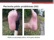 Презентация 'Diabētiskās pēdas aprūpe', 9.