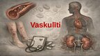 Презентация 'Vaskulīti', 1.