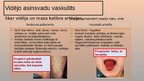 Презентация 'Vaskulīti', 6.