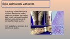 Презентация 'Vaskulīti', 8.