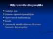 Презентация 'Demielinizējošās centrālās nervu sistēmas slimības', 26.