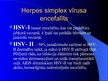 Презентация 'Herpes vīrusa CNS bojājums', 2.