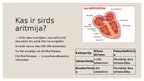 Презентация 'Dzīvībai bīstamas aritmijas', 2.