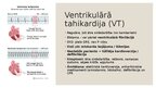 Презентация 'Dzīvībai bīstamas aritmijas', 5.
