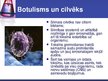 Презентация 'Botulisms', 5.