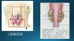 Презентация 'Endokrīnā sistēma', 23.