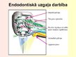 Презентация 'Stomatoloģija. Endodontijas ierīces', 9.