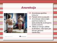 Презентация 'Anoreksija un bulīmija', 2.