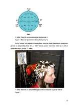 Реферат 'Elektroencefalogrammas reģistrēšanas metodika, izmantojot datorprogrammu Win EEG', 23.