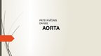 Презентация 'Aorta', 1.