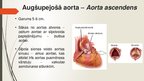 Презентация 'Aorta', 11.