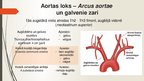 Презентация 'Aorta', 13.