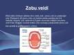 Презентация 'Zobu pastas ietekme uz mutes dobumu', 4.