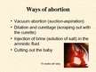 Презентация 'Abortion', 3.