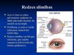 Презентация 'Izplatītākās redzes un dzirdes slimības', 2.