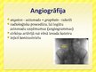 Презентация 'Angiogrāfija', 4.