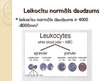 Презентация 'Leikoze. Hroniska limfoleikoze', 2.