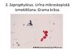 Презентация 'Staphylococcus saprophyticus baktērijas', 5.