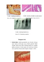 Конспект 'Odontogēnas un neodontogēnas žokļu cistas', 12.