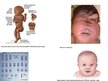 Презентация 'Ģenētikas pētīšanas metodes - amniocentēze', 11.