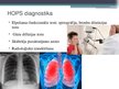 Презентация 'Hroniska obstruktīva plaušu slimība', 9.