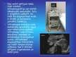 Презентация 'Medicīnas tehnoloģijas: rentgens, ultrasonogrāfija', 7.