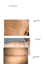 Реферат 'Rētas', 7.