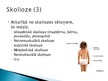Презентация 'Korsete - palīglīdzeklis idioptiskās skoliozes ārstēšanai pusaudžu vecumā', 7.