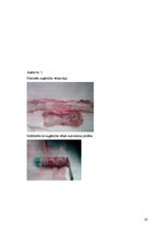 Реферат 'Pēc A.femoralis aneirismas protezēšanas iegūtās infekcijas pacientiem', 20.