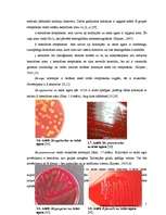Реферат 'Ģints "streptococcus" mikroorganismu izolēšana no patoloģiskā materiāla un ident', 7.