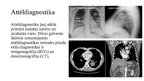 Презентация 'Plauša vēža jaunākas diagnostikas un ārstēšanas metodes', 4.