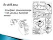 Презентация 'Pylorus stenoze', 20.