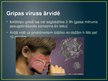 Презентация 'Vīrusu infekcijas', 8.