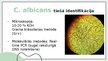 Презентация 'Candida albicans mikrobioloģiskās diagnostikas principi', 5.