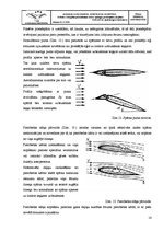 Реферат 'Cēlējspēka palielināšanas ierīces: spraugas, aizspārni, priekšspārni', 14.