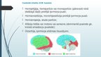 Презентация 'Išēmisks insults', 8.