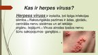 Презентация 'Herpes vīruss', 2.