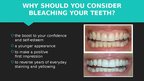 Презентация 'Professional Teeth Bleaching', 2.