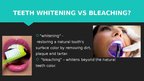 Презентация 'Professional Teeth Bleaching', 3.