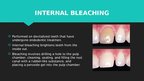 Презентация 'Professional Teeth Bleaching', 9.